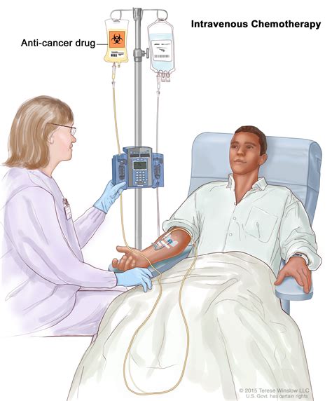 infusion therapy for melanoma